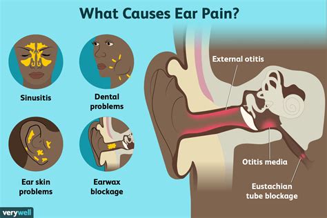 What Can Cause Ear Pain And Headache